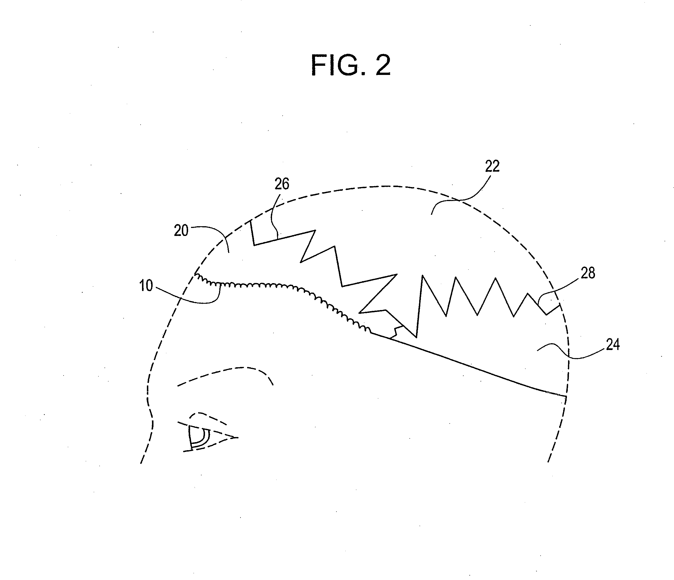 Hairpiece and method of making same