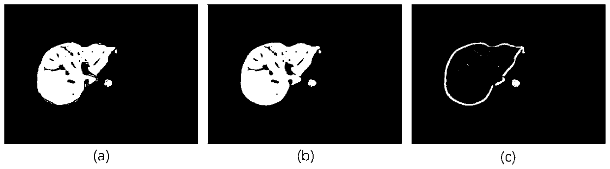 MRI image liver fibrosis automatic grading method based on imaging omics analysis