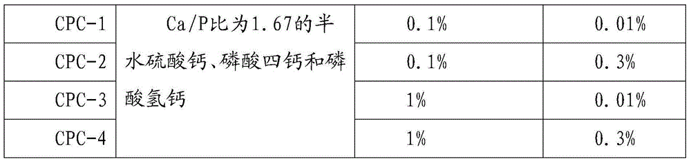 Injectable bone cement with antioxidation characteristic as well as preparation method and application thereof