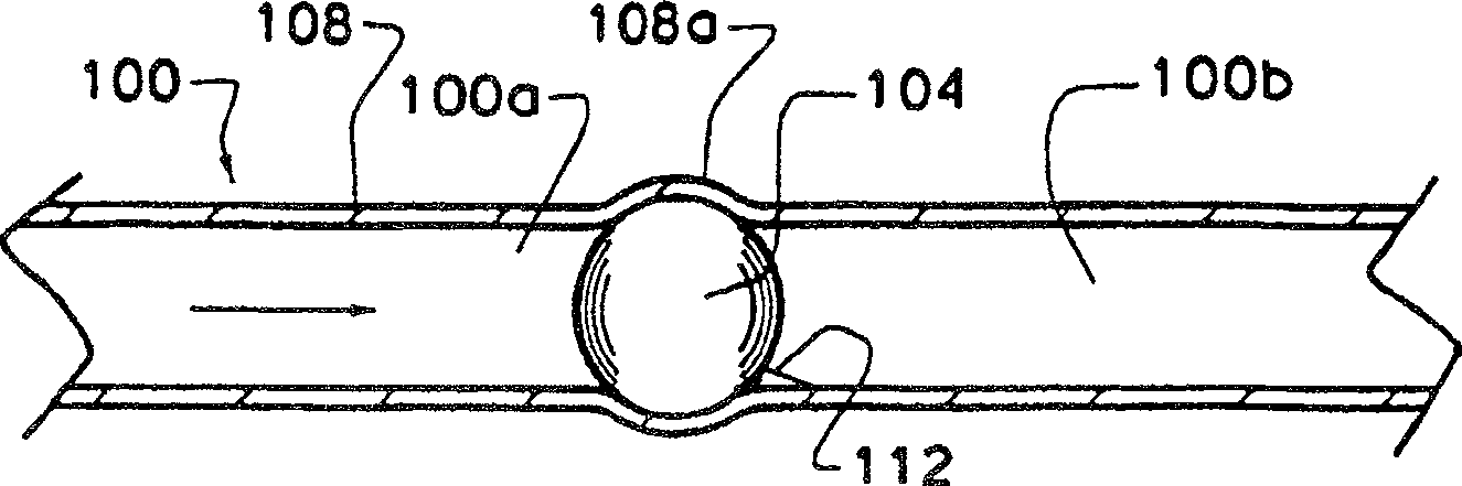 Apparatus and method for preventing free flow in an infusion line