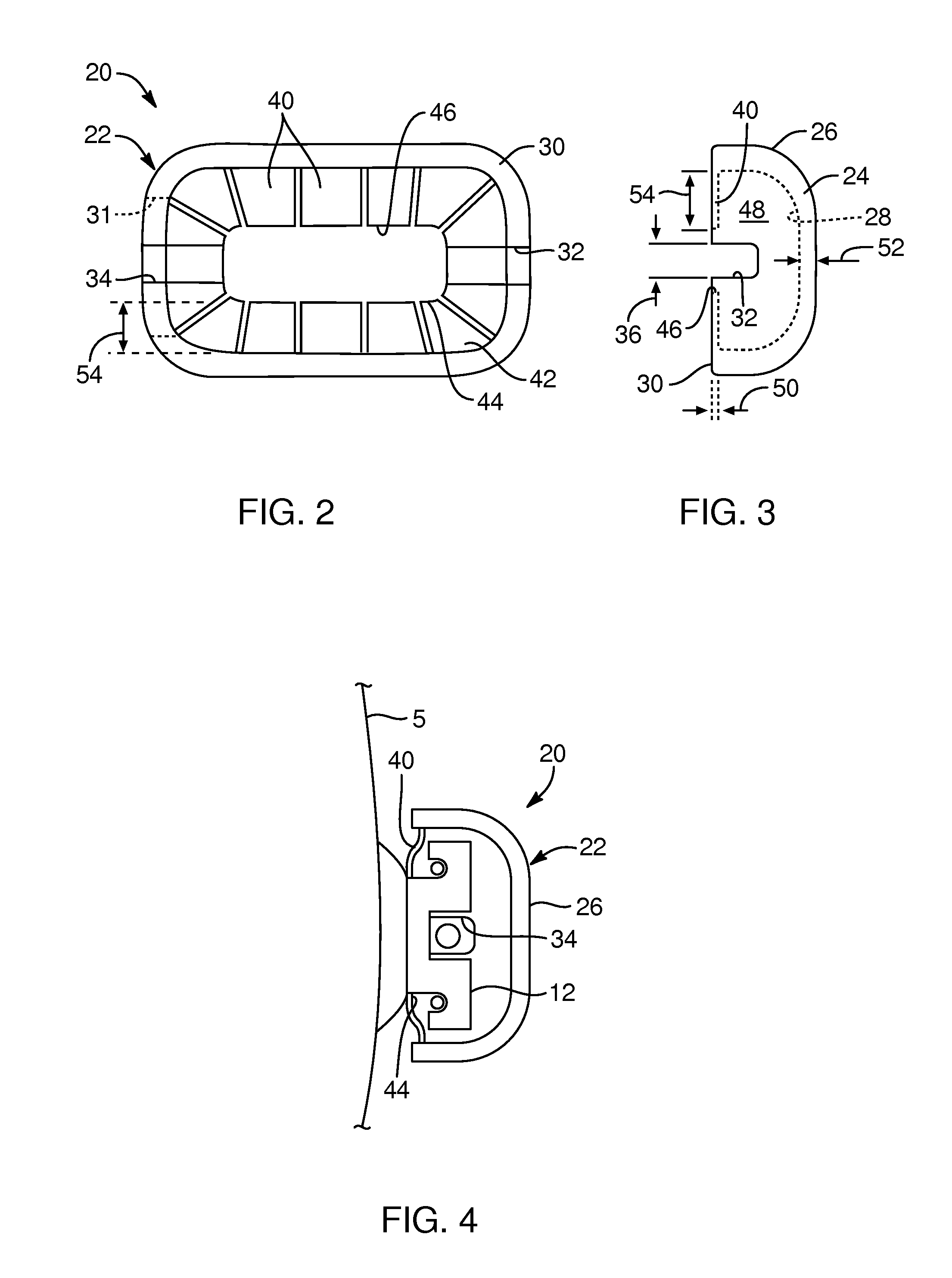 Devices, systems, and methods for orthodontic hardware