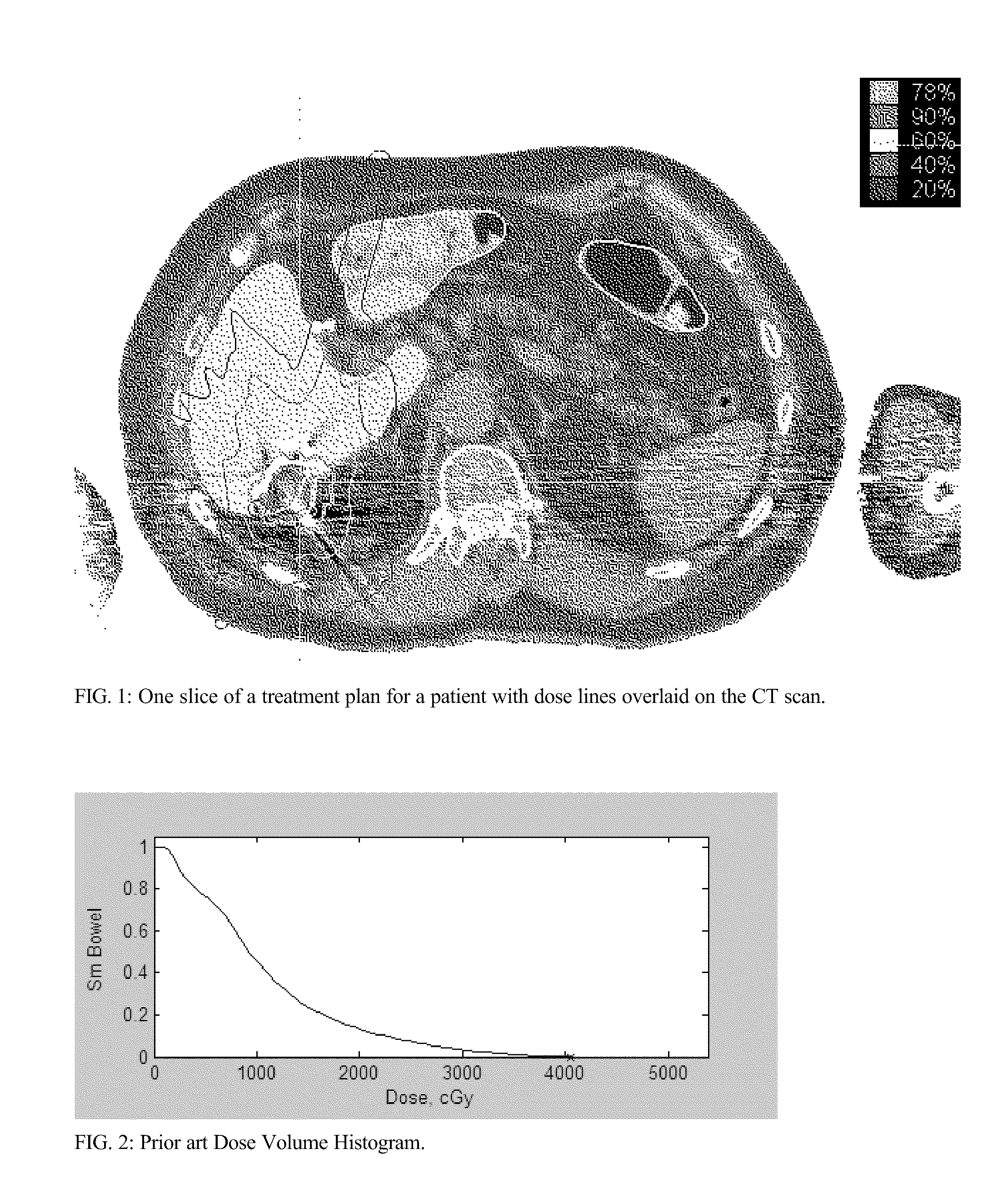 Dose Volume Histogram Evaluator