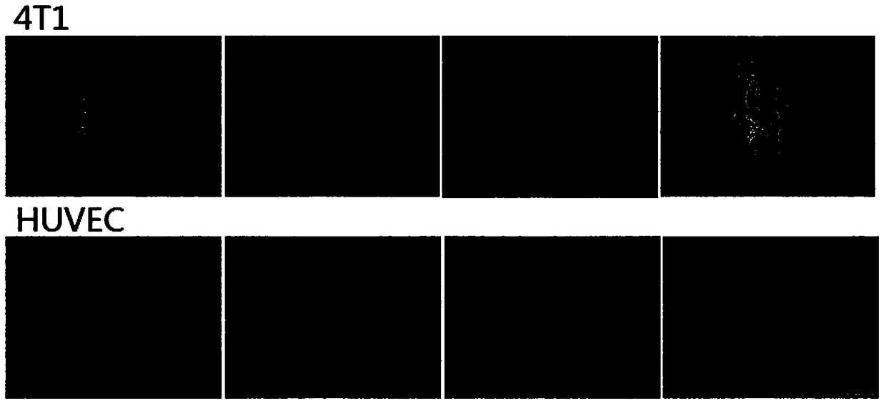 Doxorubicin and itraconazole co-loaded nanoliposomes and preparation method thereof