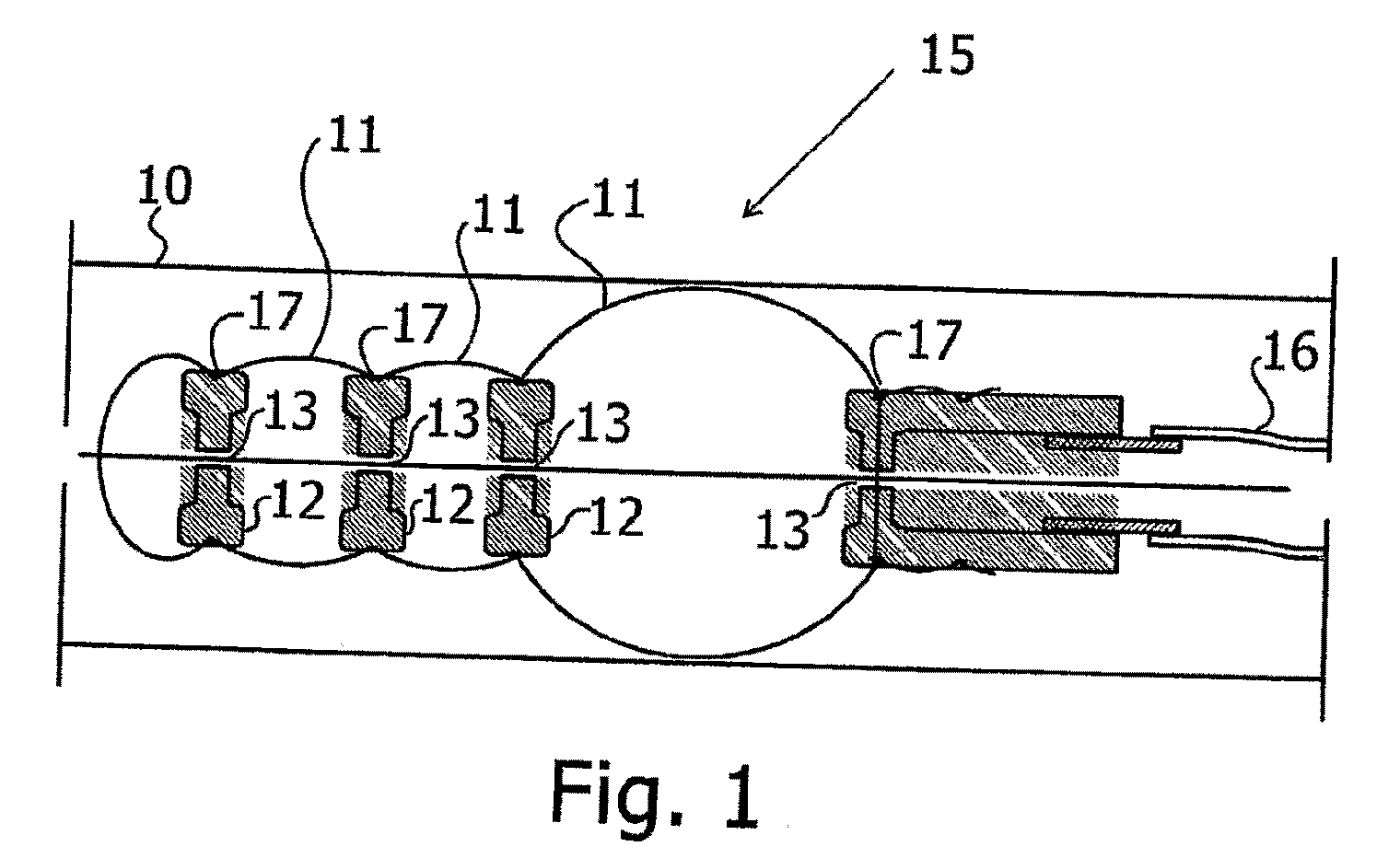 Inflatable chamber device for motion through a passage