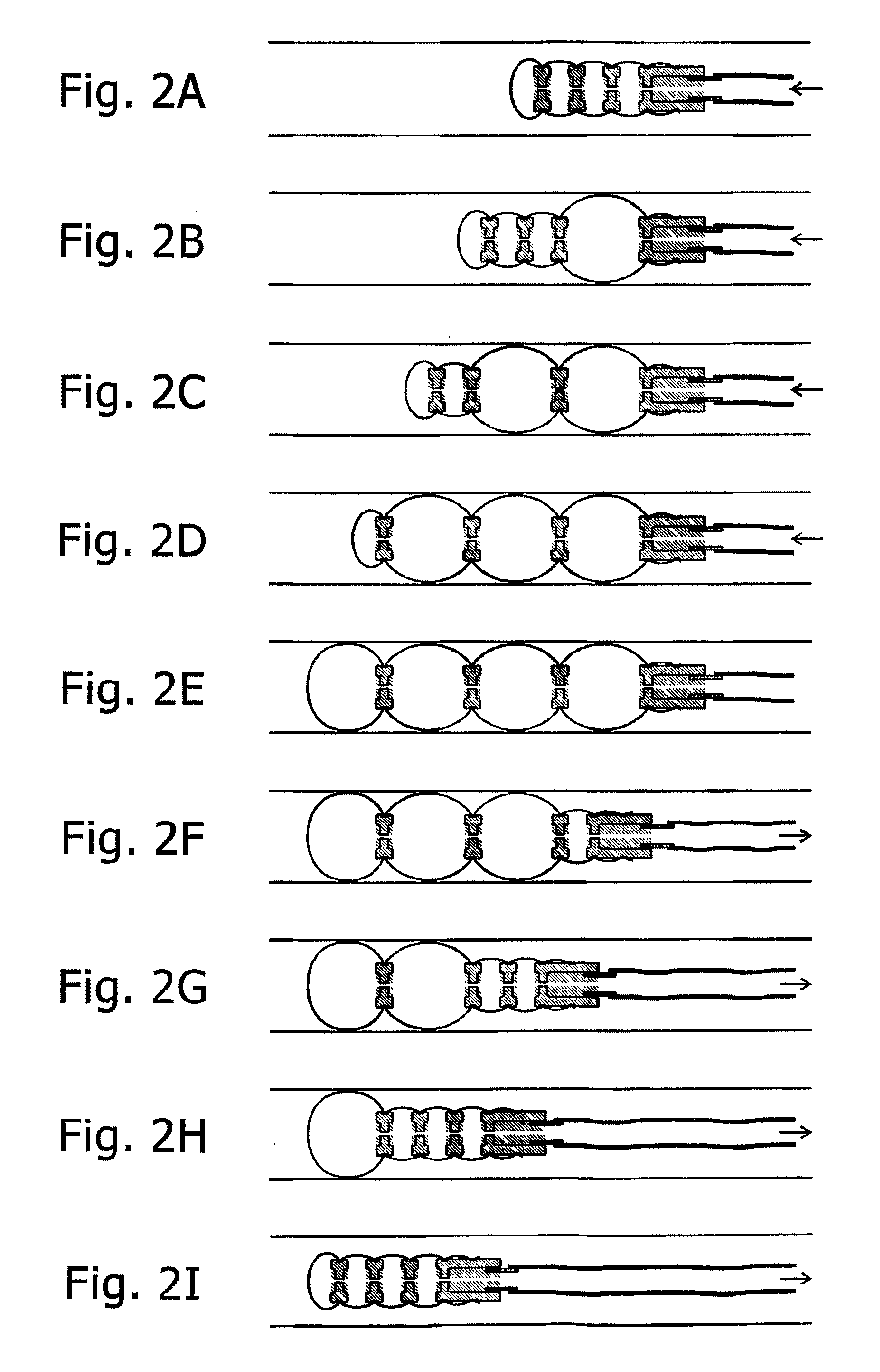 Inflatable chamber device for motion through a passage