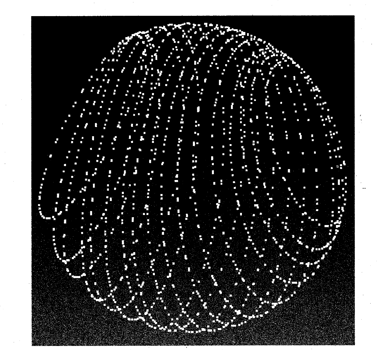 Method for rebuilding point-cloud type three-dimensional surface of nonparallel outline medical image