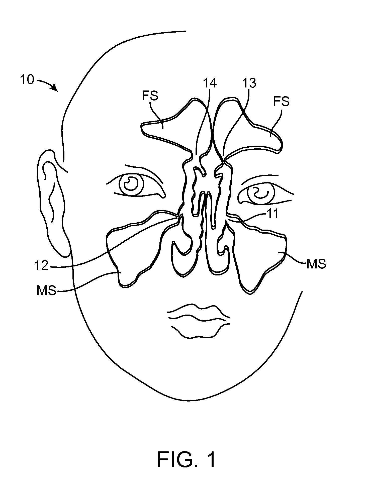 Devices and methods for inserting a sinus dilator