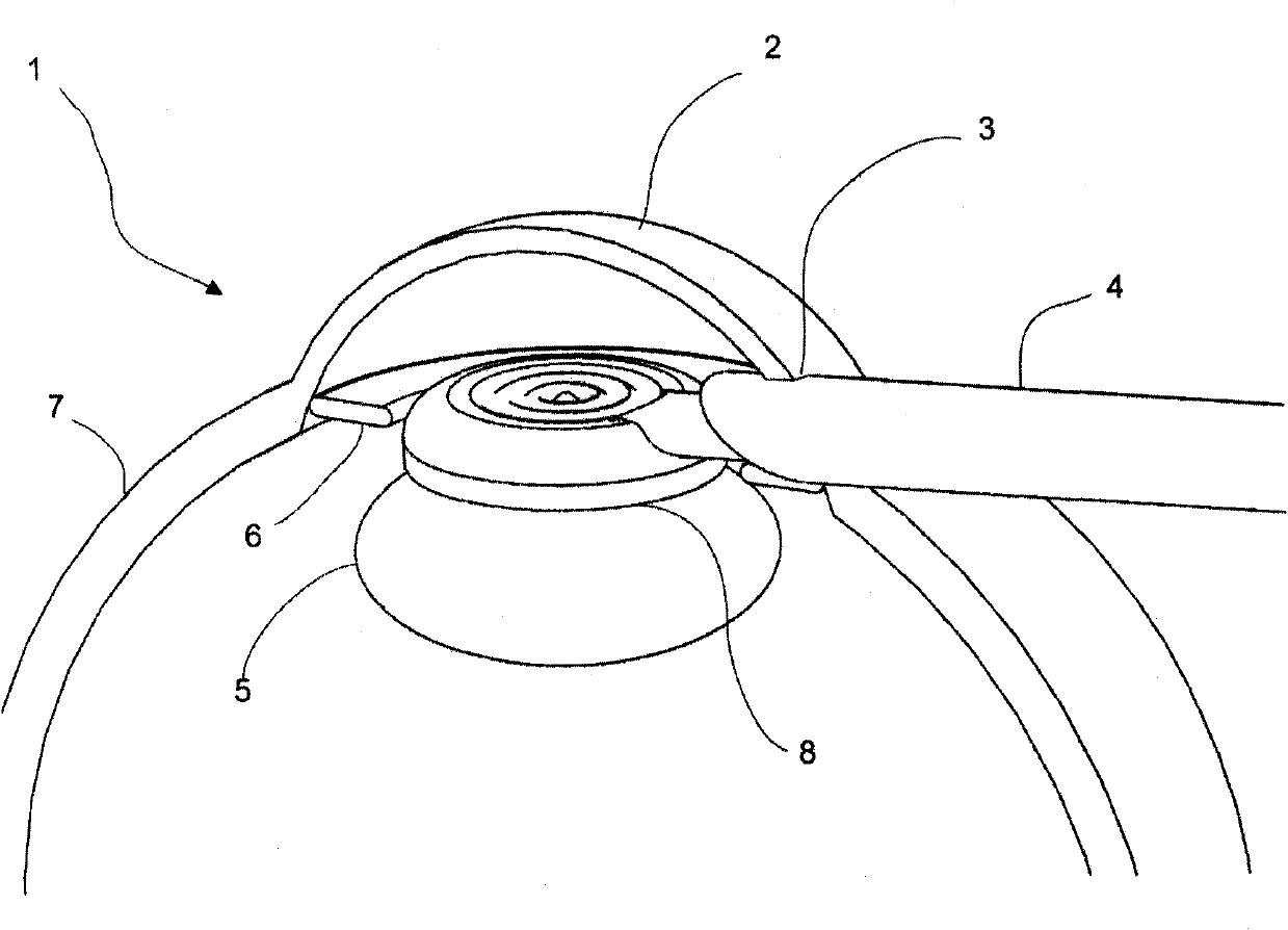 Ophthalmic surgical device for capsulotomy