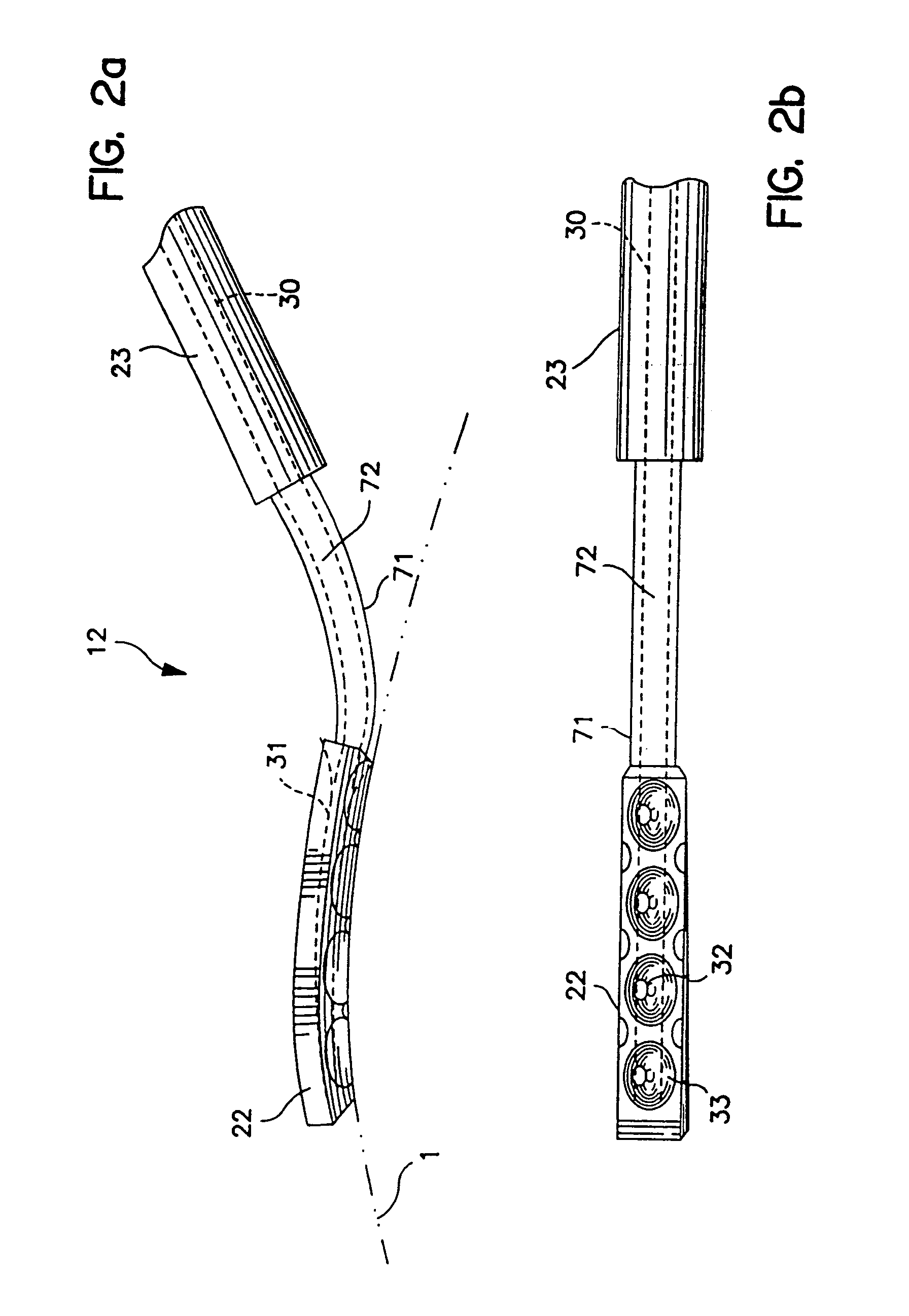 Method and apparatus for temporarily immobilizing a local area of tissue