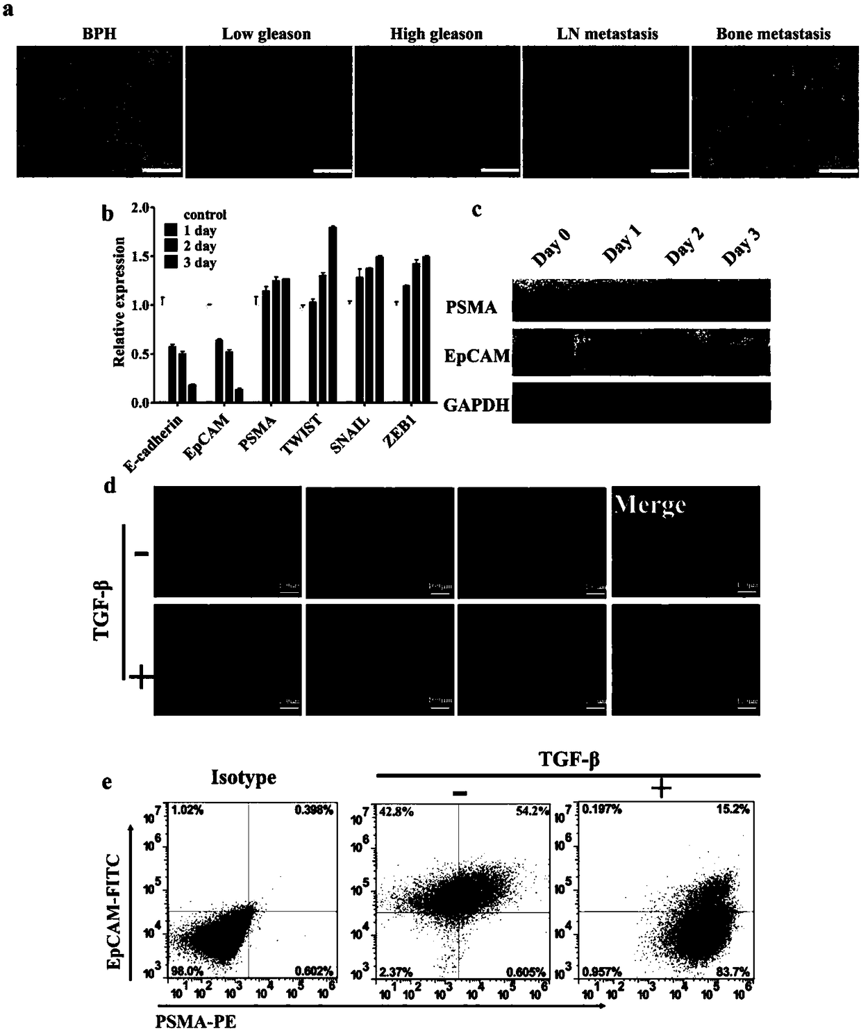 EpCAM/PSMA dual-antibody-based functionalized micro-fluidic chip as well as preparation method and application thereof