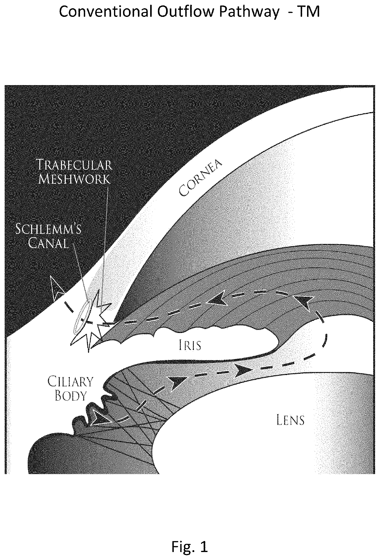 Method for laser treatment for glaucoma