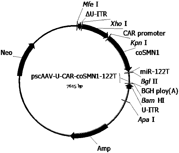 Recombinant adeno-associated viruses carrying designed SMN1 gene expression cassettes and application