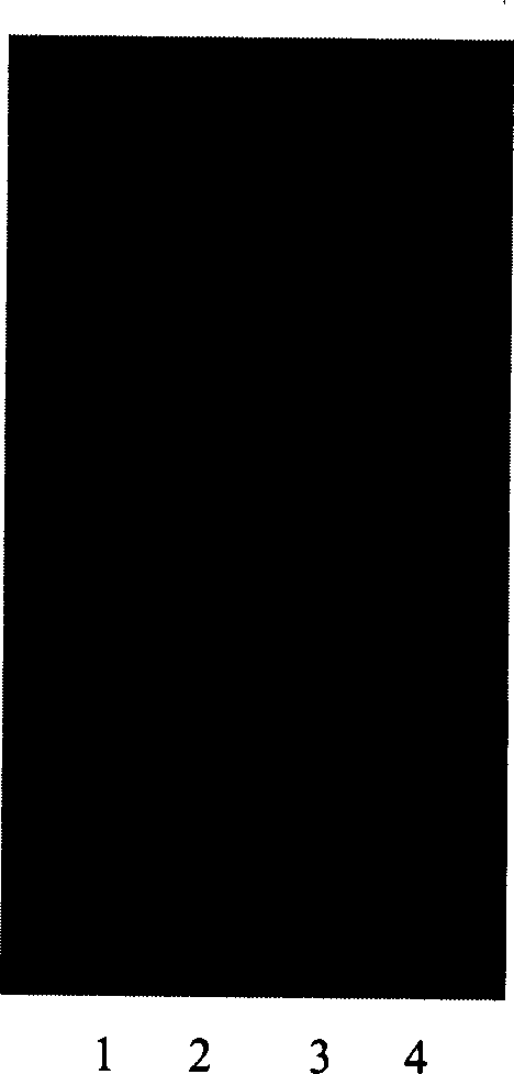 Gamma-tocopherol tranferase, gene and use thereof