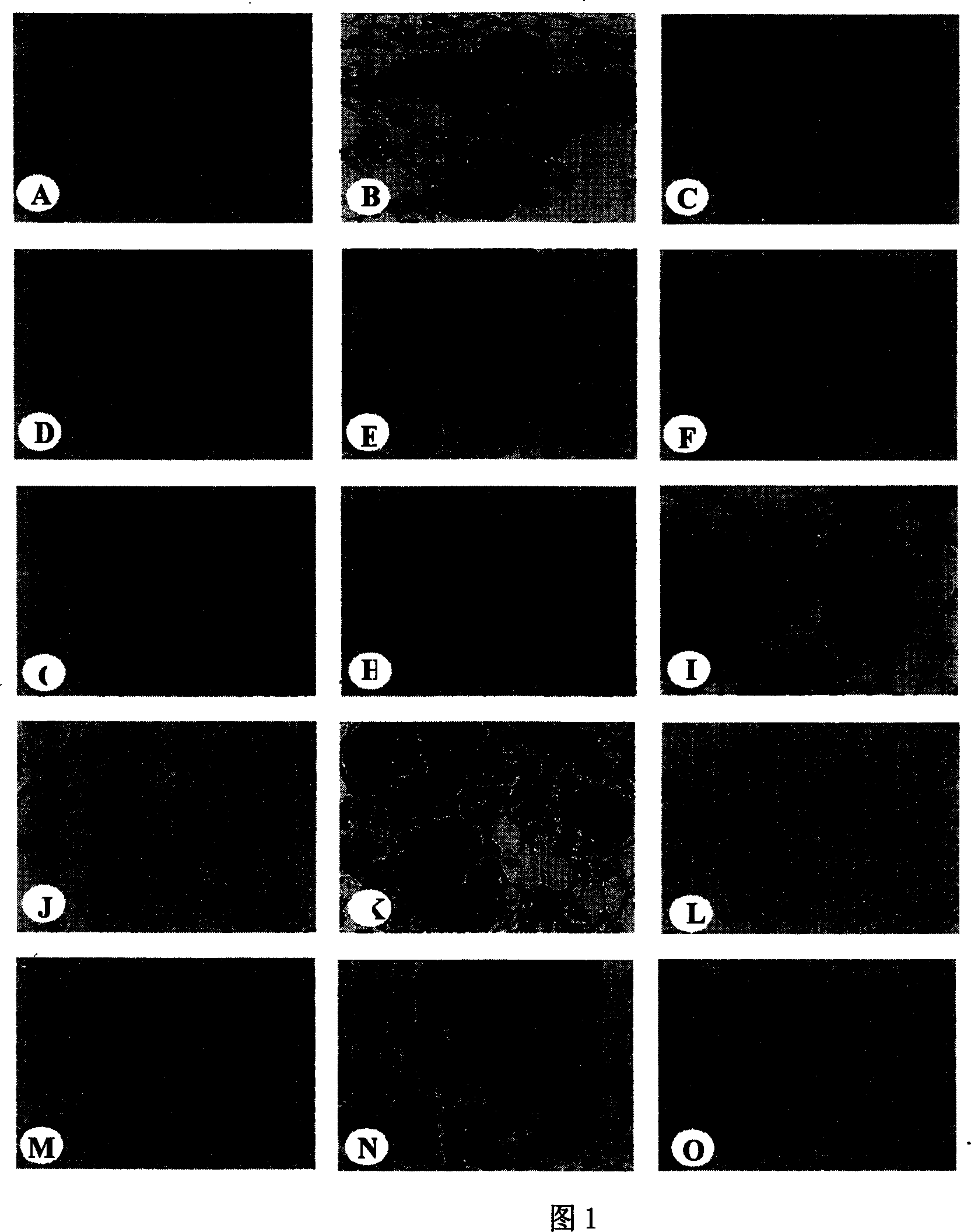 Gymnadenia conopsea extraction and its application in preparing medicine for treating pulmonary fibrosis