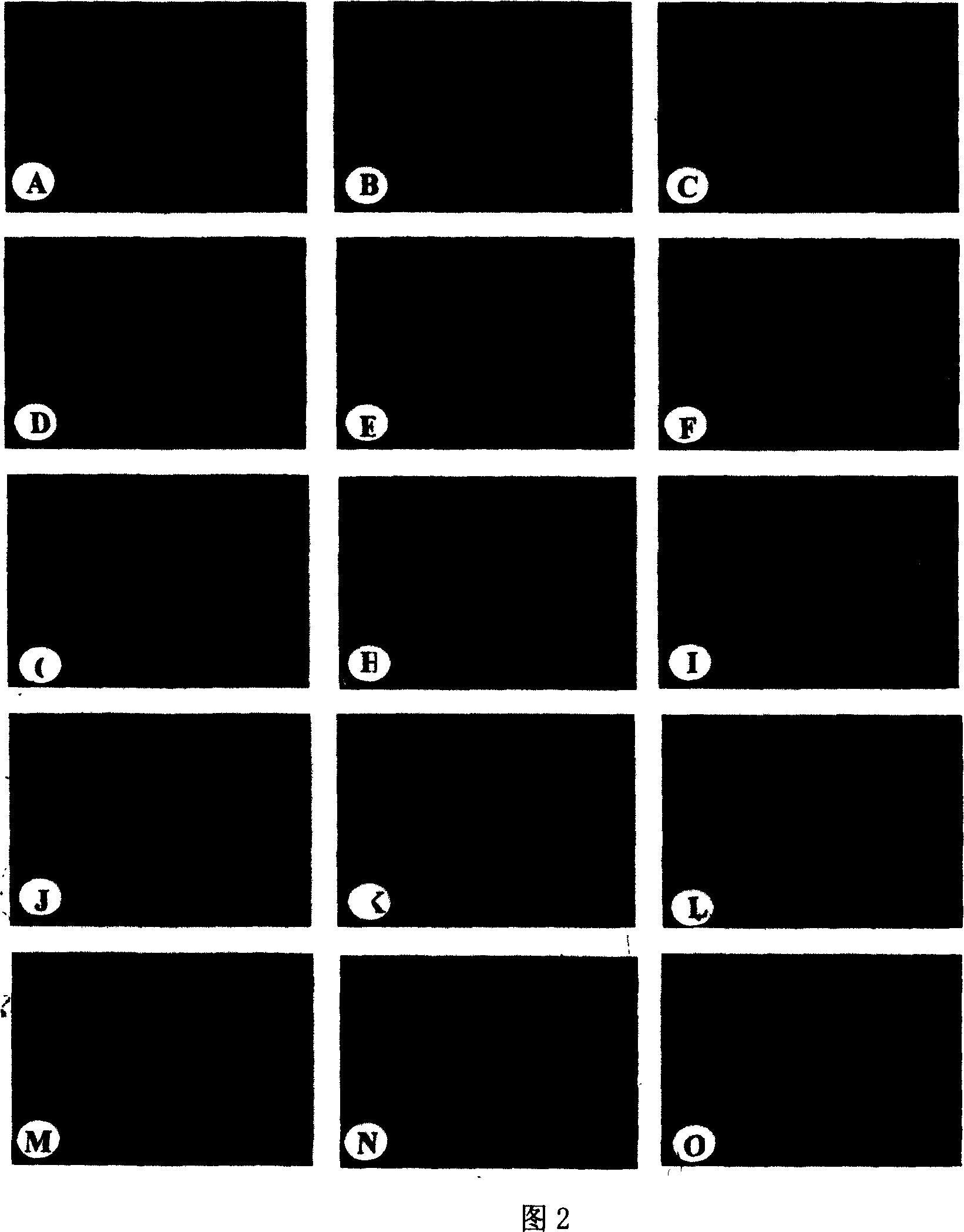 Gymnadenia conopsea extraction and its application in preparing medicine for treating pulmonary fibrosis