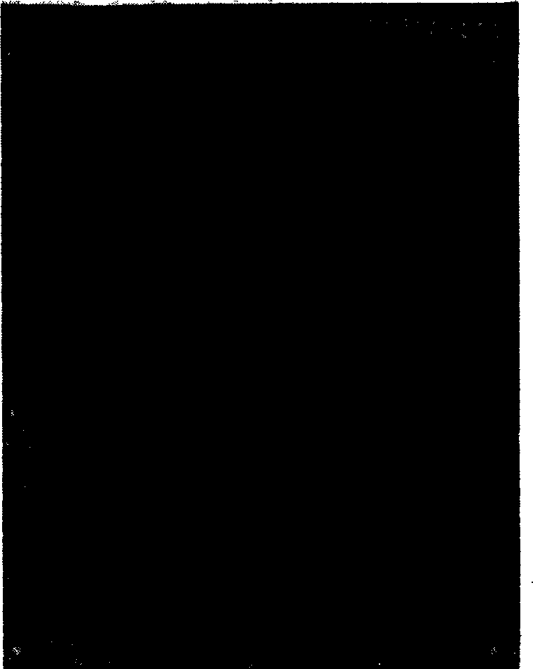 Medicine-carrying nanometer polymer particle and its prepn and use