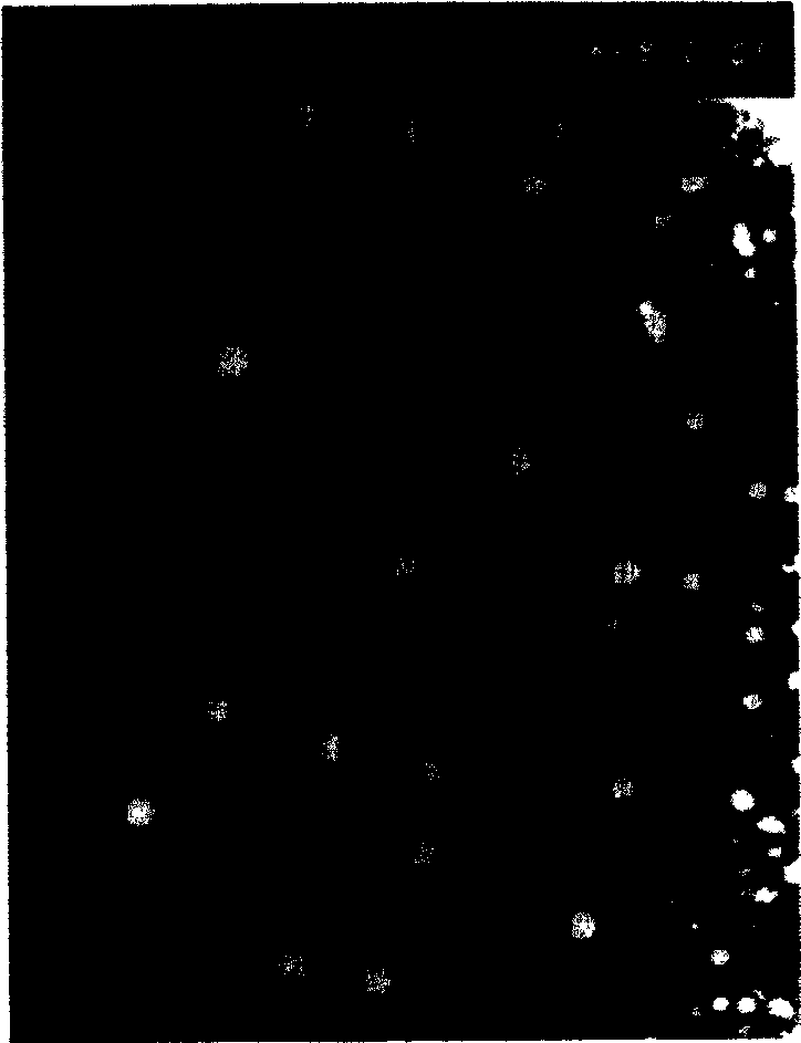 Medicine-carrying nanometer polymer particle and its prepn and use