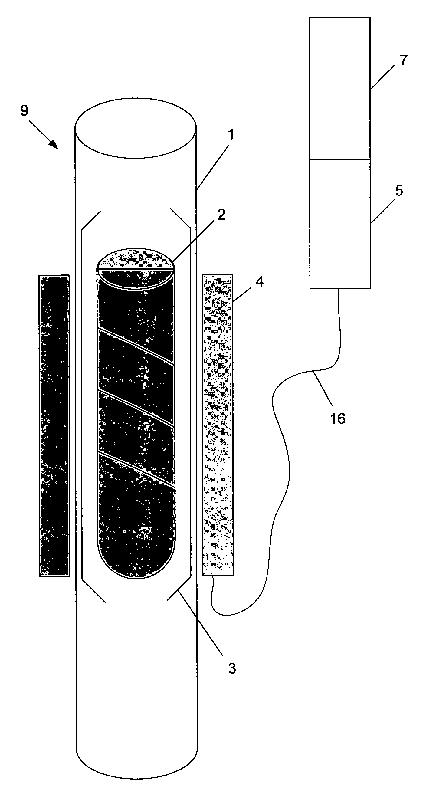 Permanent ventricular assist device for treating heart failure