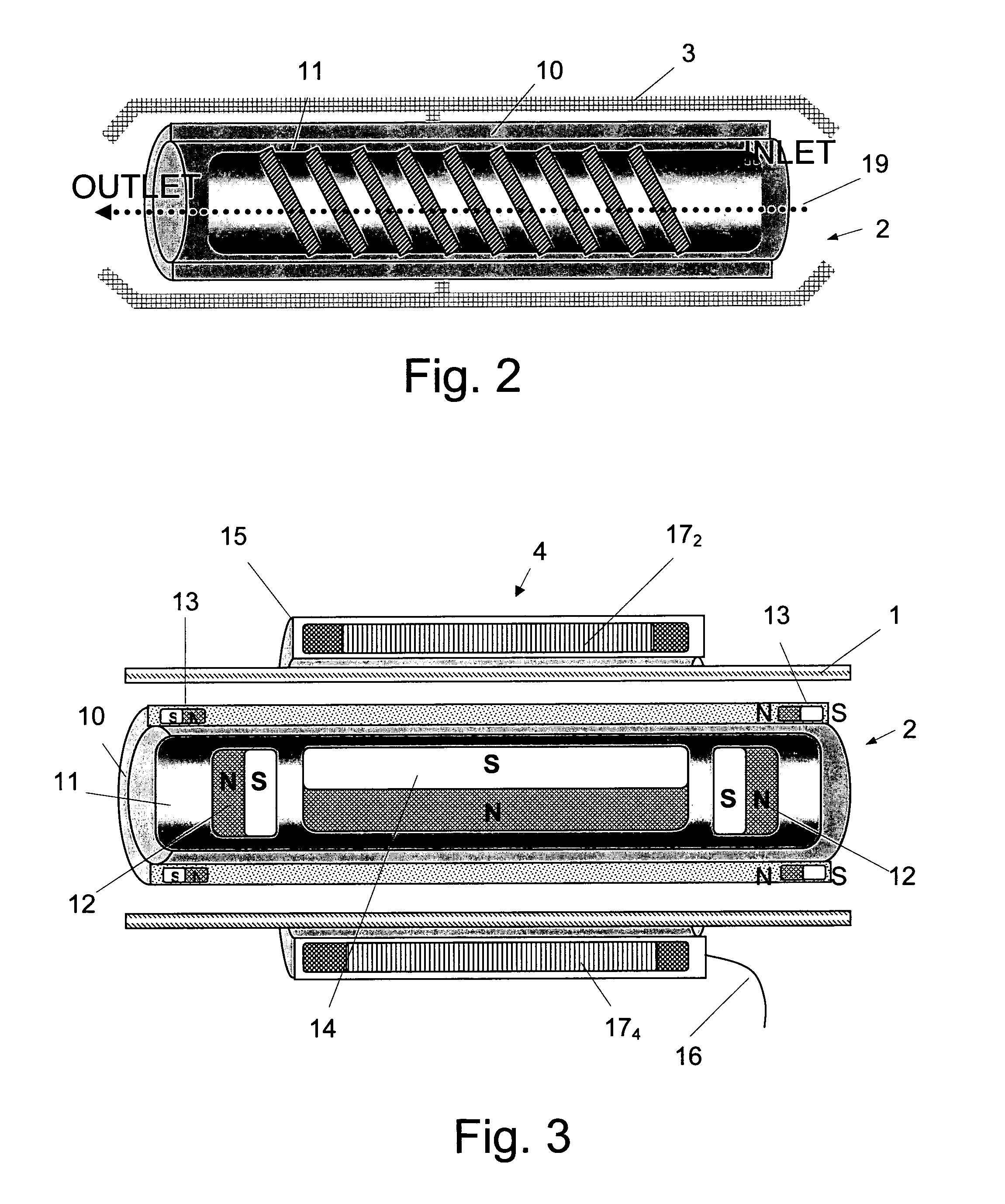 Permanent ventricular assist device for treating heart failure