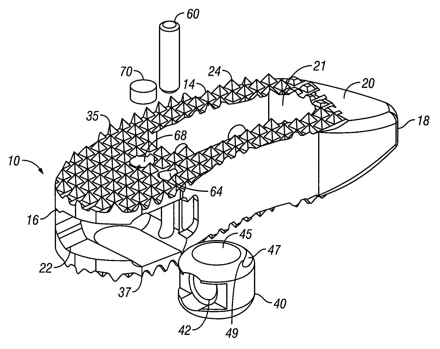 Articulating Spacer