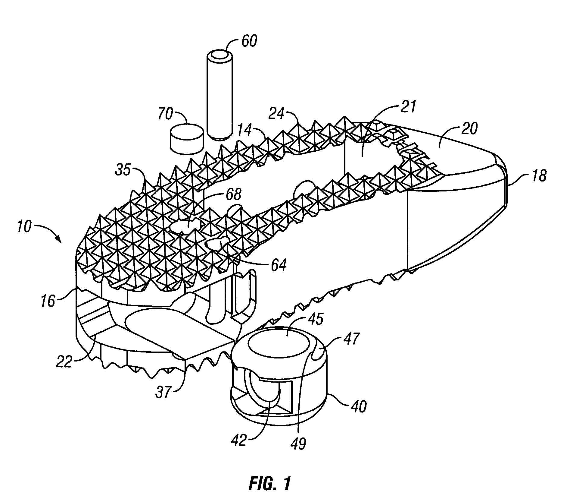 Articulating Spacer