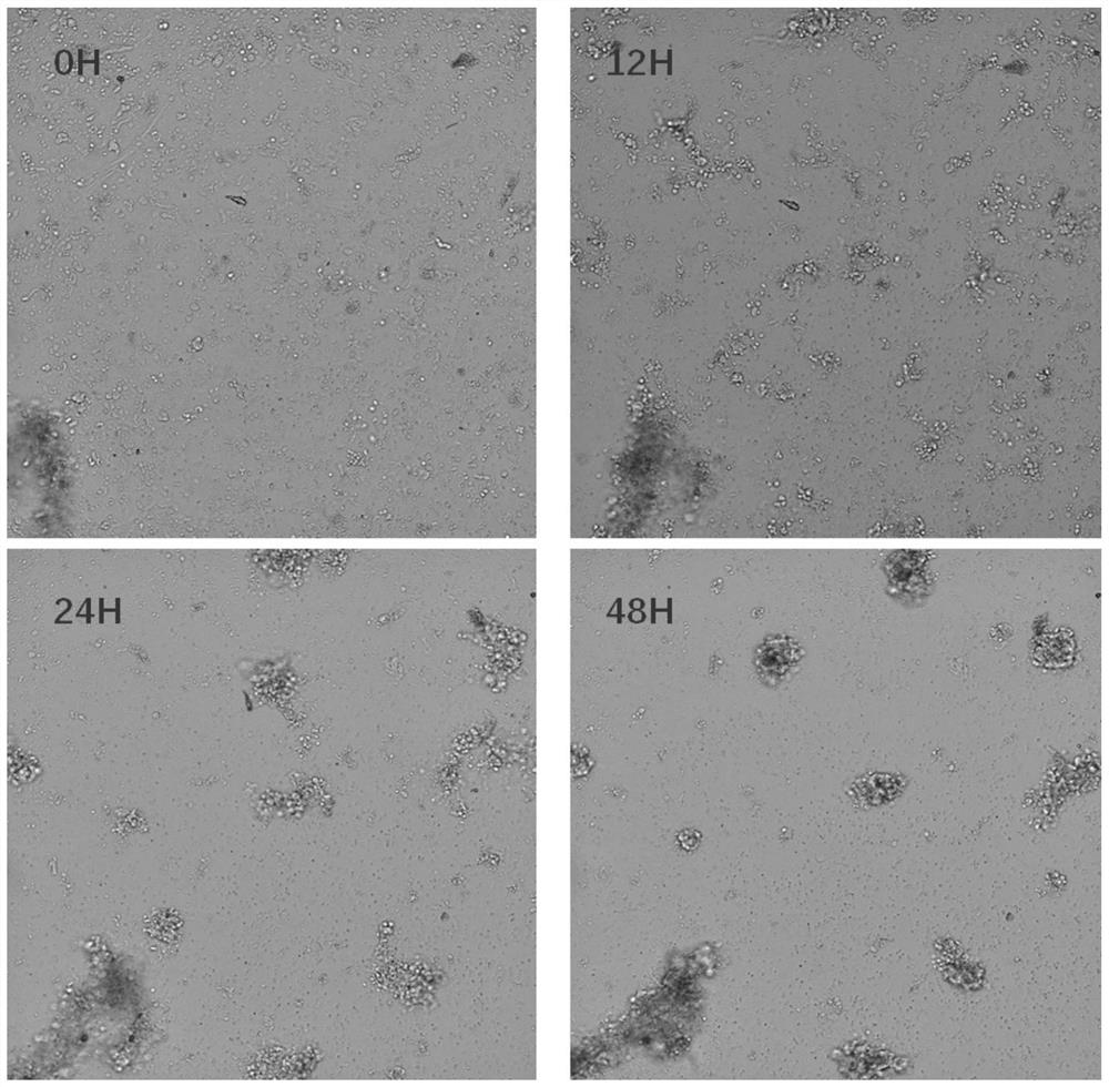 Culture method of gastric cancer micro-tumor cell model