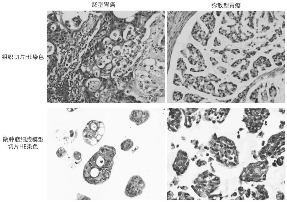 Culture method of gastric cancer micro-tumor cell model