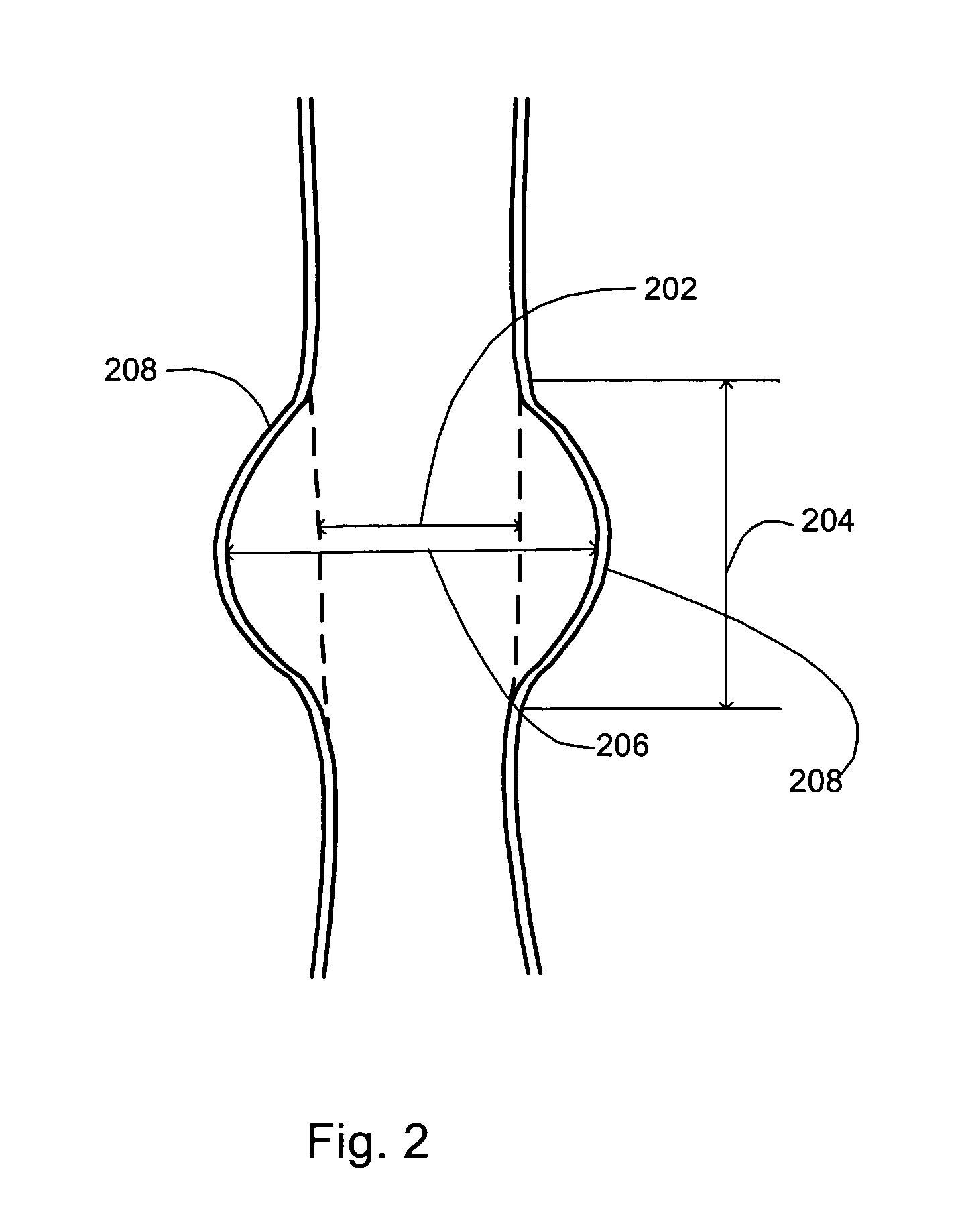 Methods and devices for extravascular intervention