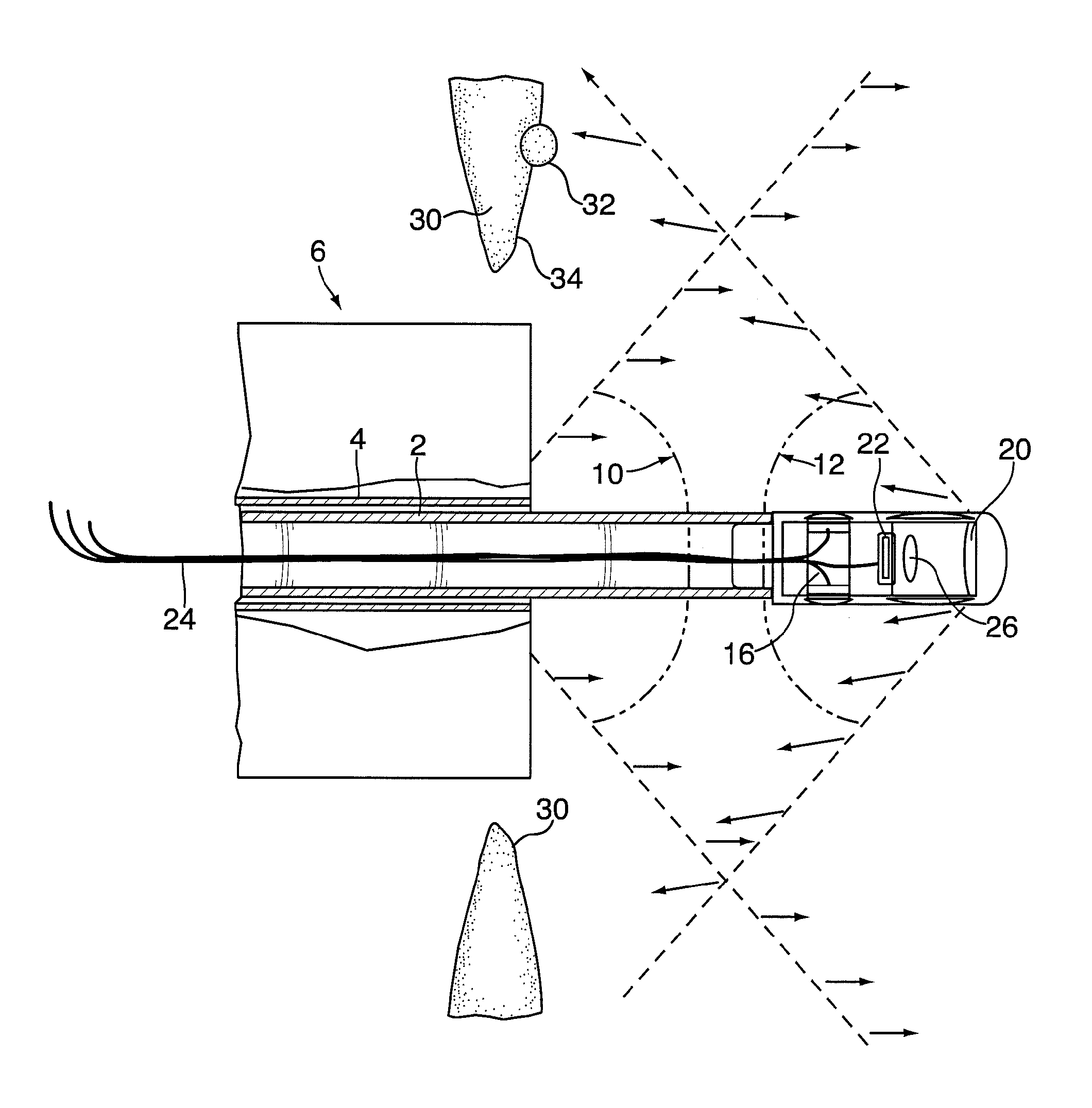 Method and device for imaging an interior surface of a corporeal cavity