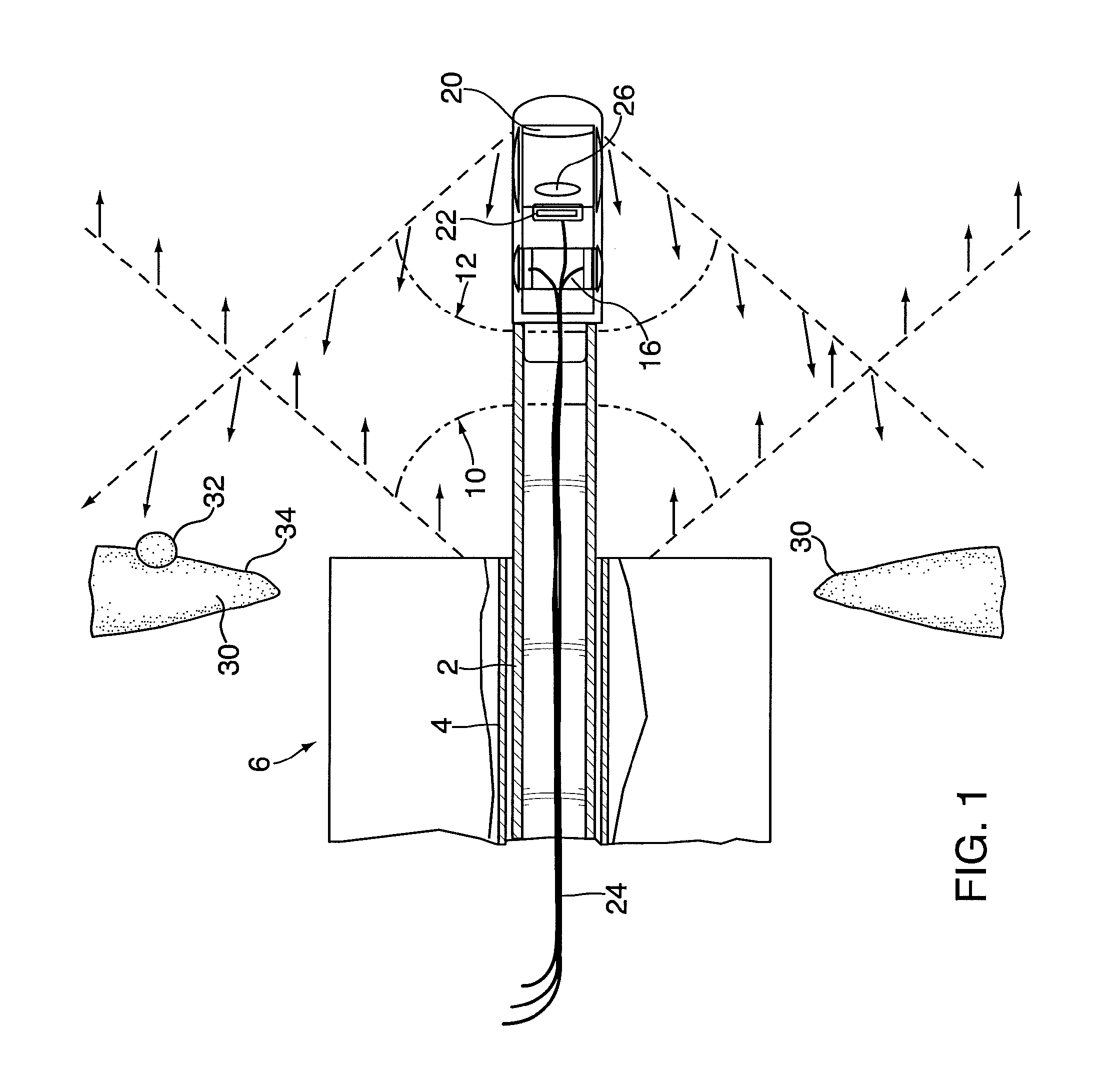 Method and device for imaging an interior surface of a corporeal cavity