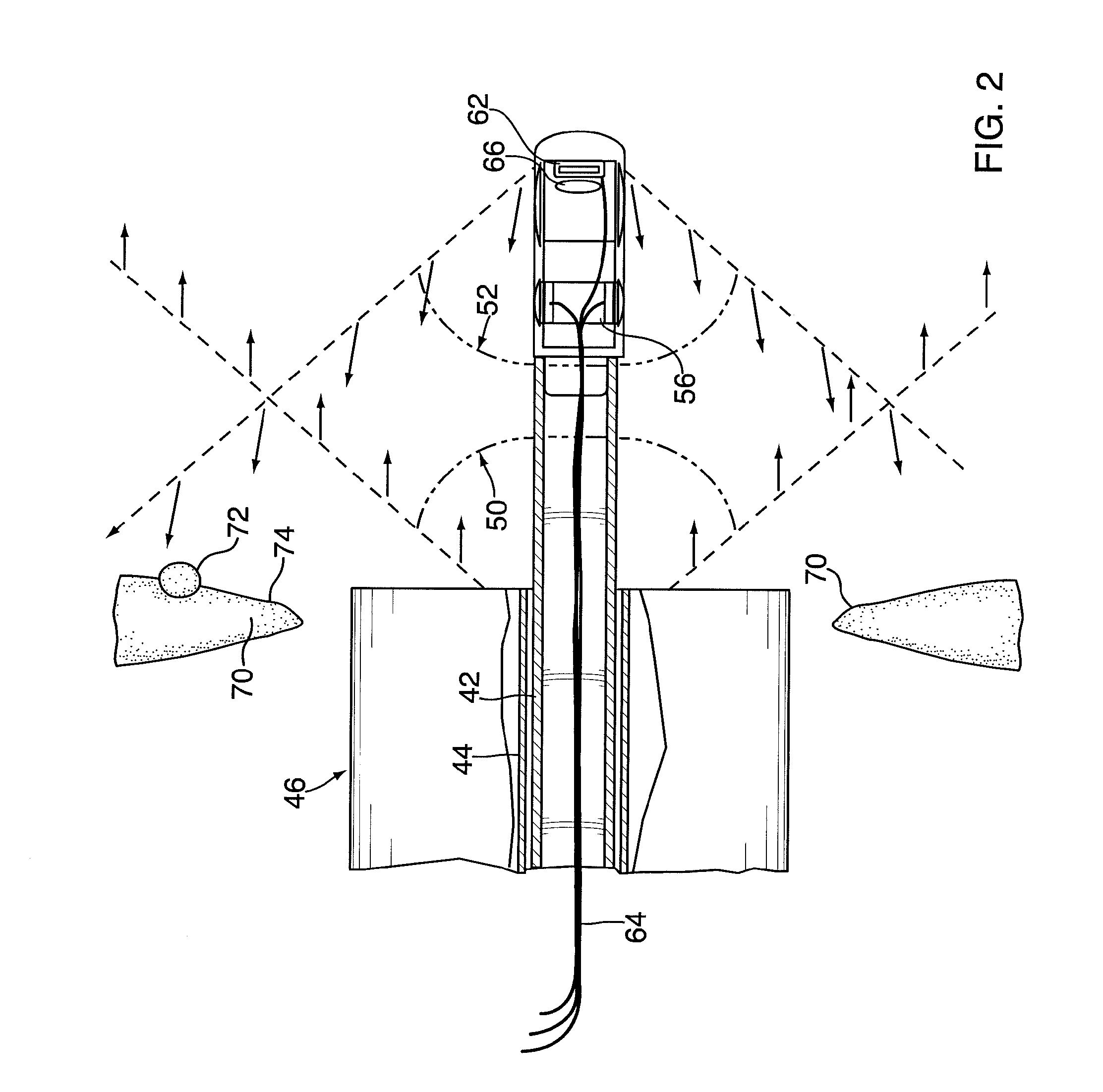 Method and device for imaging an interior surface of a corporeal cavity