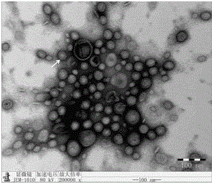 Preparation method of APP (Actinobacillus Pleuropneumoniae) OMVs (Outer Membrane Vesicles) and vaccine of APP OMVs