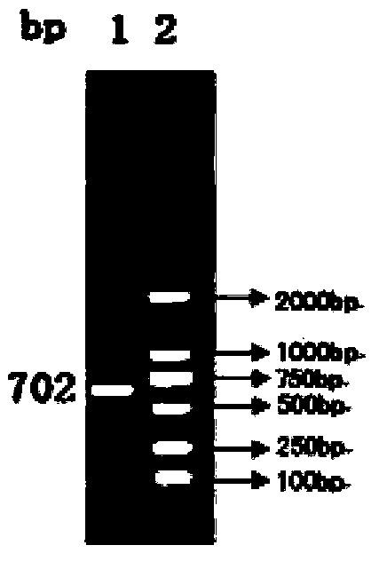 Vaccine composition resisting porcine circovirus and porcine infectious pleuropneumonia infection and preparation