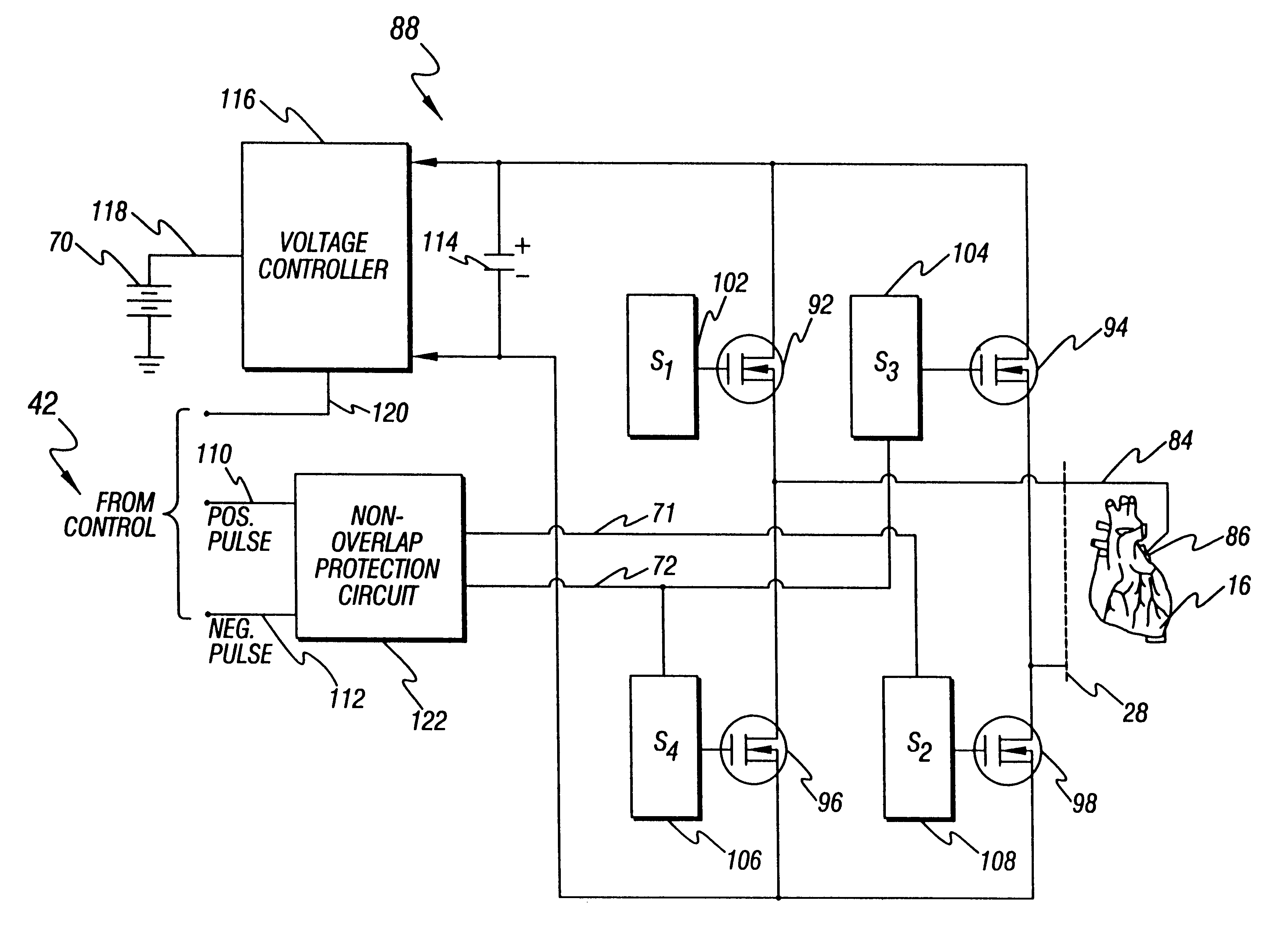 Method and apparatus for treatment of cardiac electromechanical dissociation