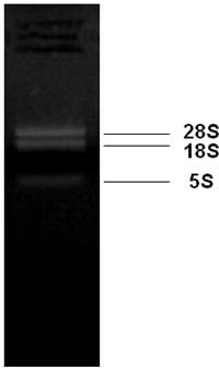 Extraction method for South American wedelia chinensis total ribonucleic acid (RNA)