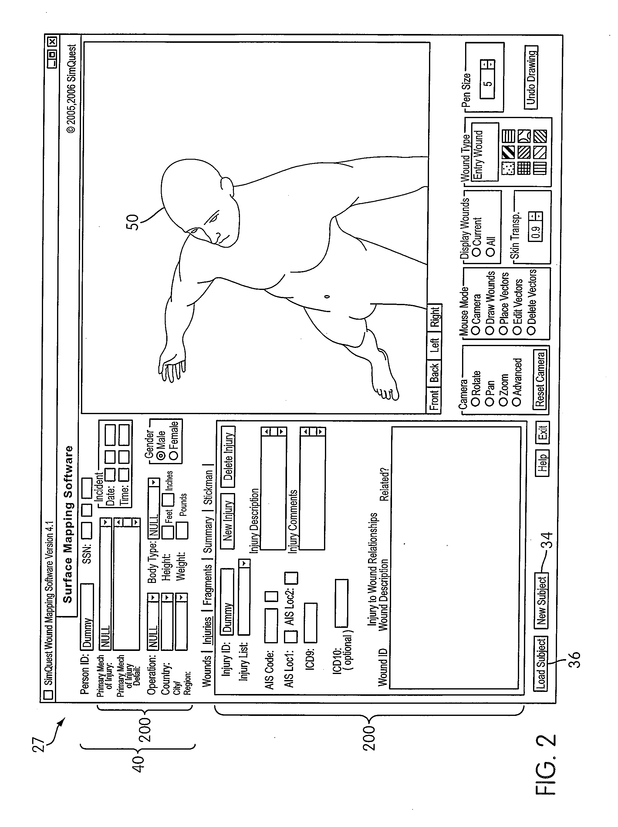 Method and apparatus for collecting and analyzing surface wound data