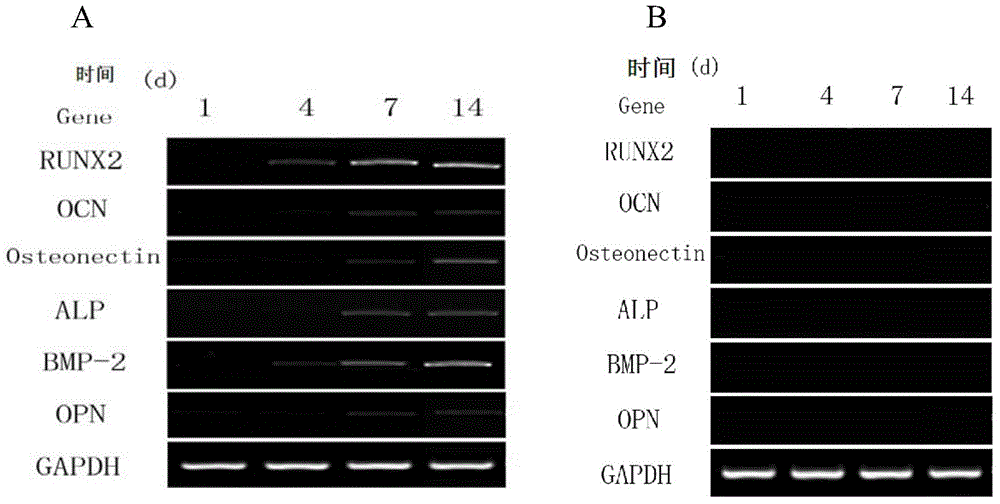 Method for infecting mesenchymal stem cells by Runx2 recombinant lentiviruses to express osteoblastic genes