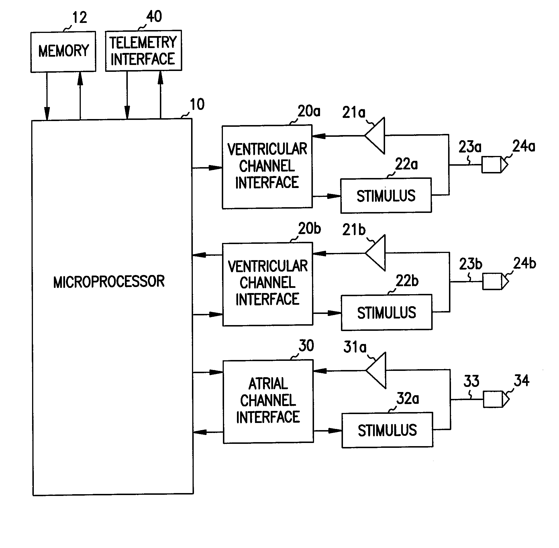 Apparatus and method for spatially and temporally distributing cardiac electrical stimulation