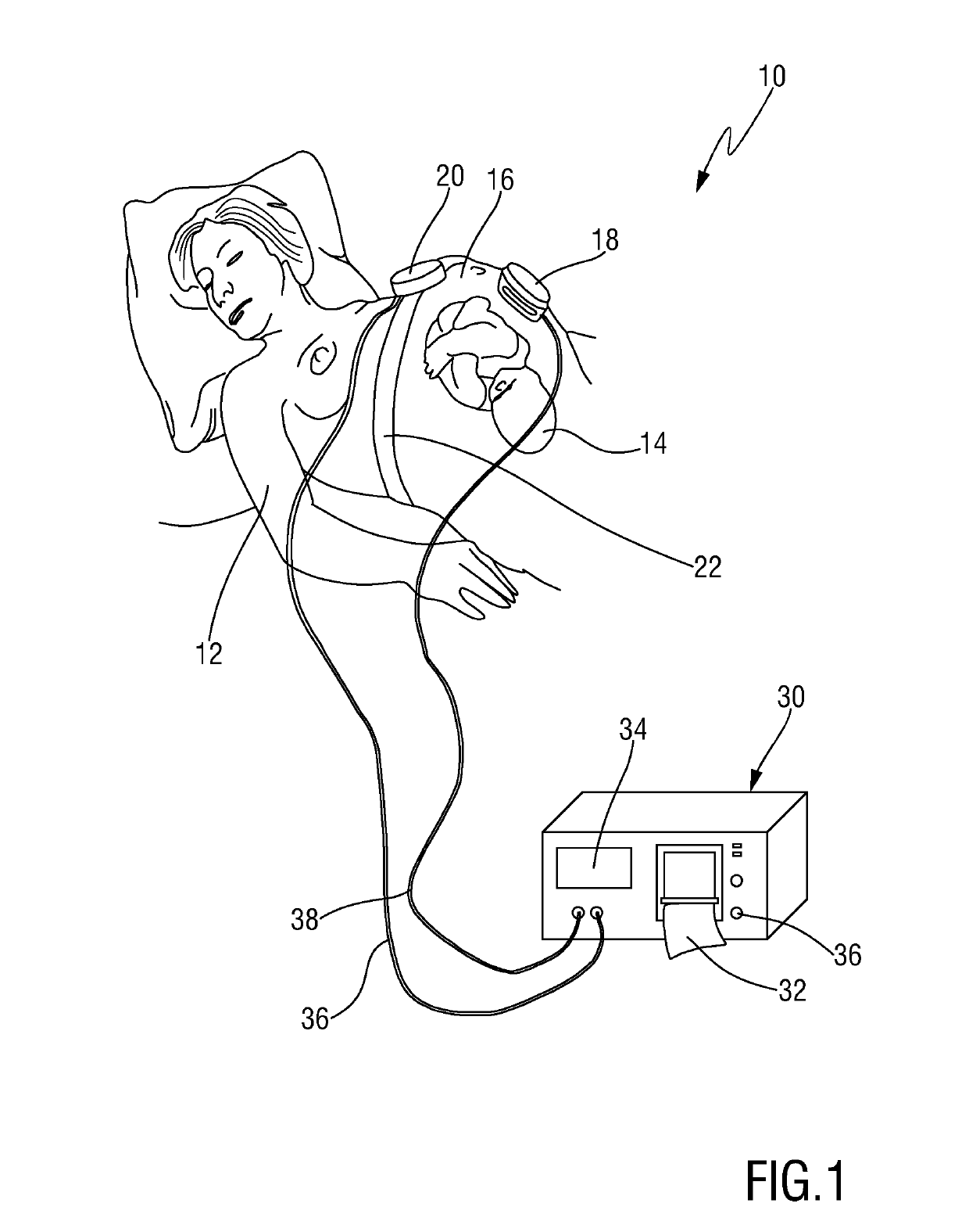 Maternal monitoring transducer and operating method