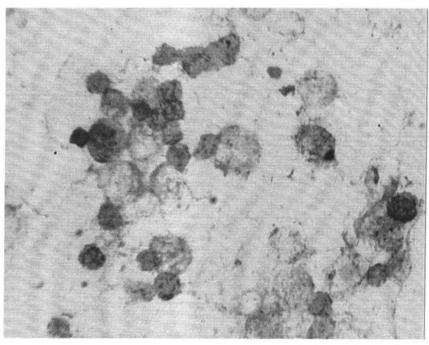 In-situ hybridization detection assay kit and detection method for ABCA5 gene and application of kit