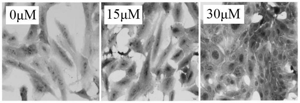 Application of AhR inhibitor to induction of chondrogenic differentiation of mesenchymal stem cells and treatment of related diseases