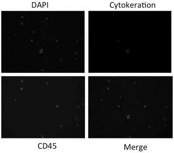 Separation and detection methods of circulating tumor cells