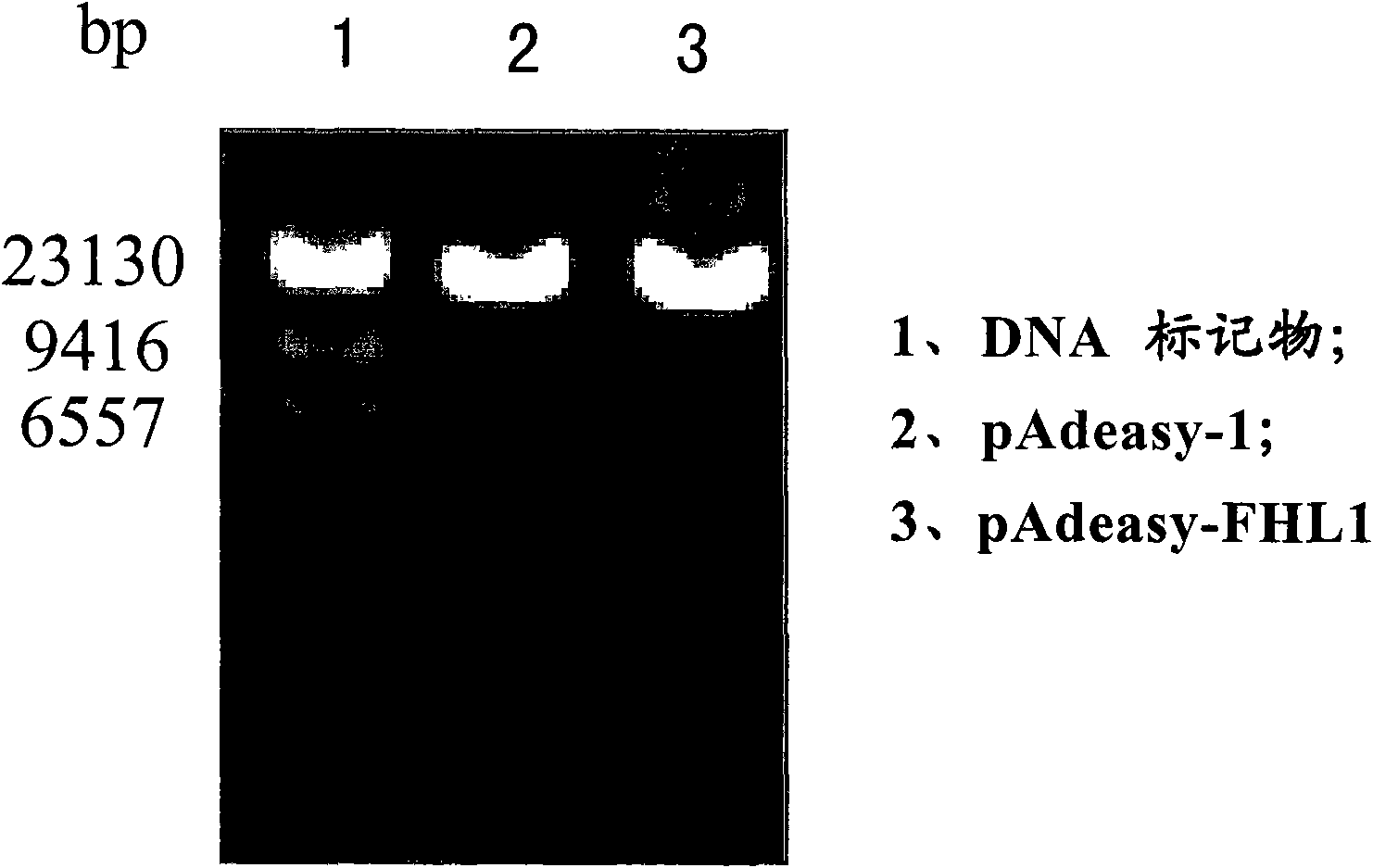 Application of FHL 1 in preparing medicament for treating tumour