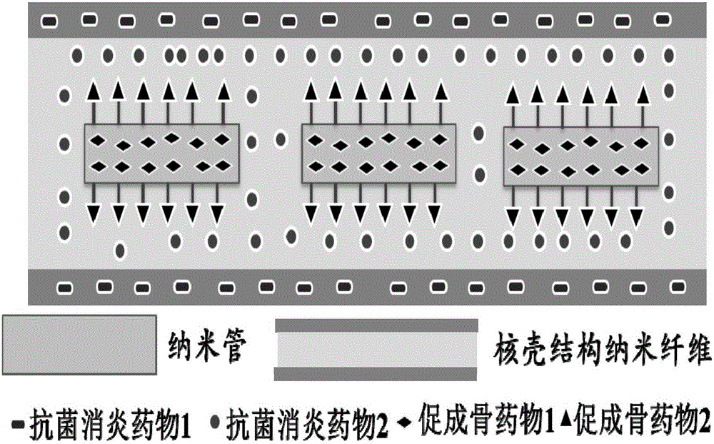 Preparation method of bone restoration material containing multiple drug-loaded slow release systems