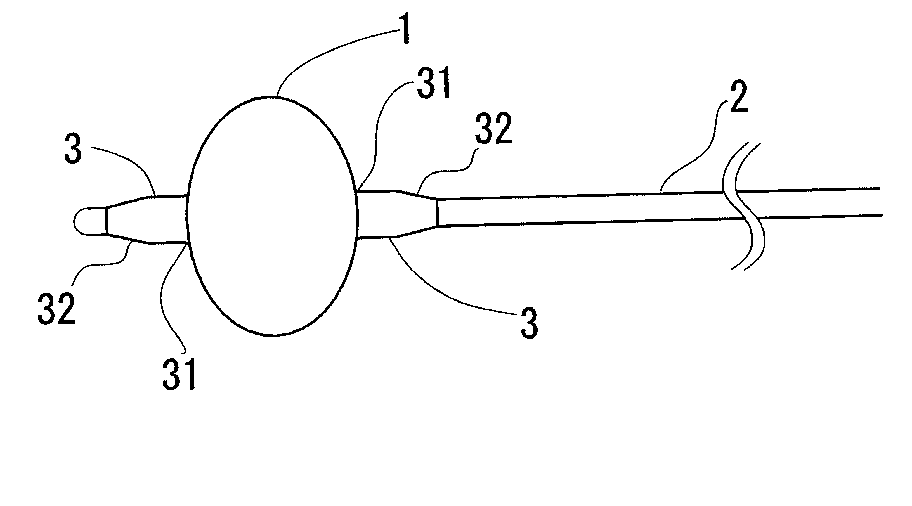 Balloon catheter