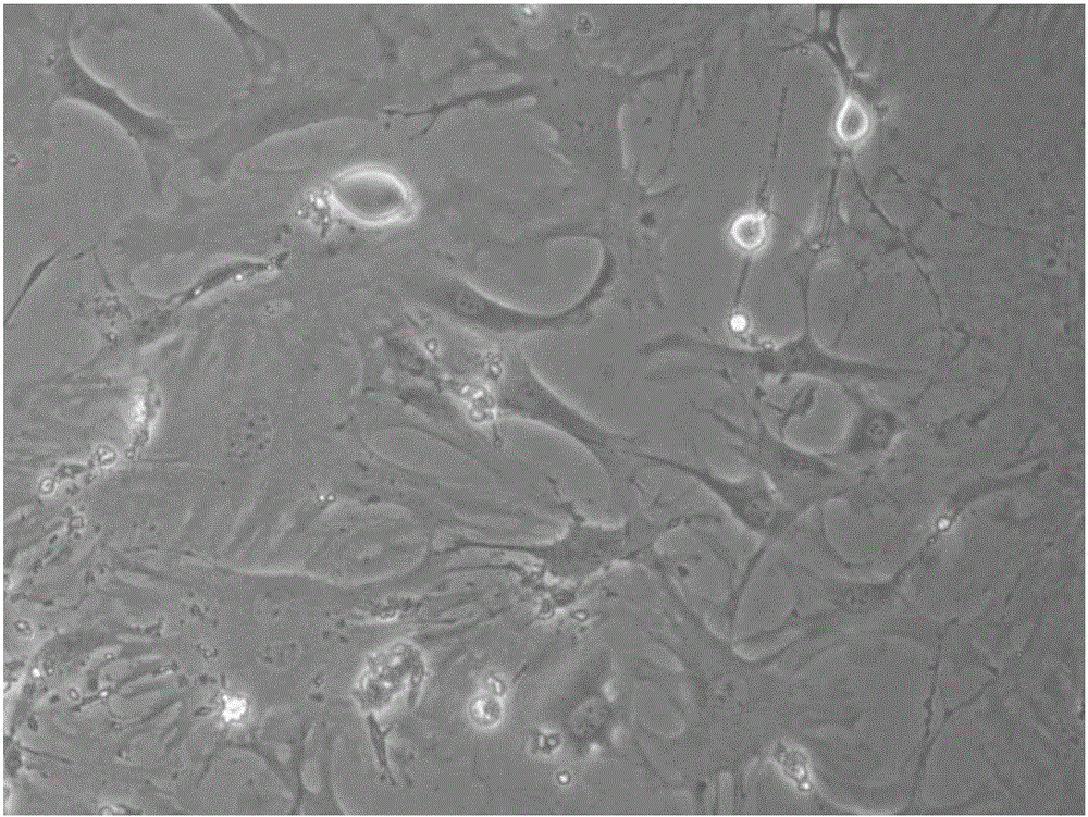 Isolation and culture method for primary rat aortic smooth muscle cells