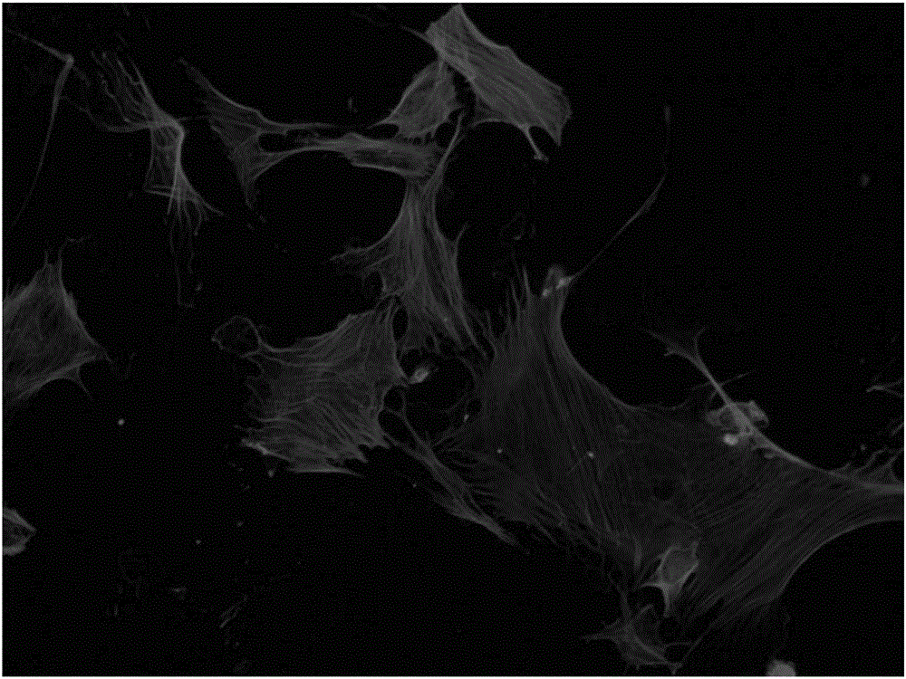 Isolation and culture method for primary rat aortic smooth muscle cells