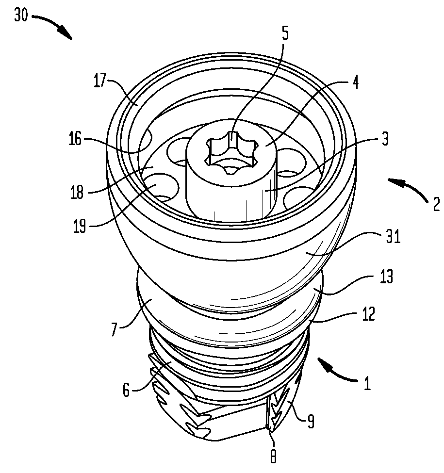 Coupling apparatus for a bone anchored hearing device