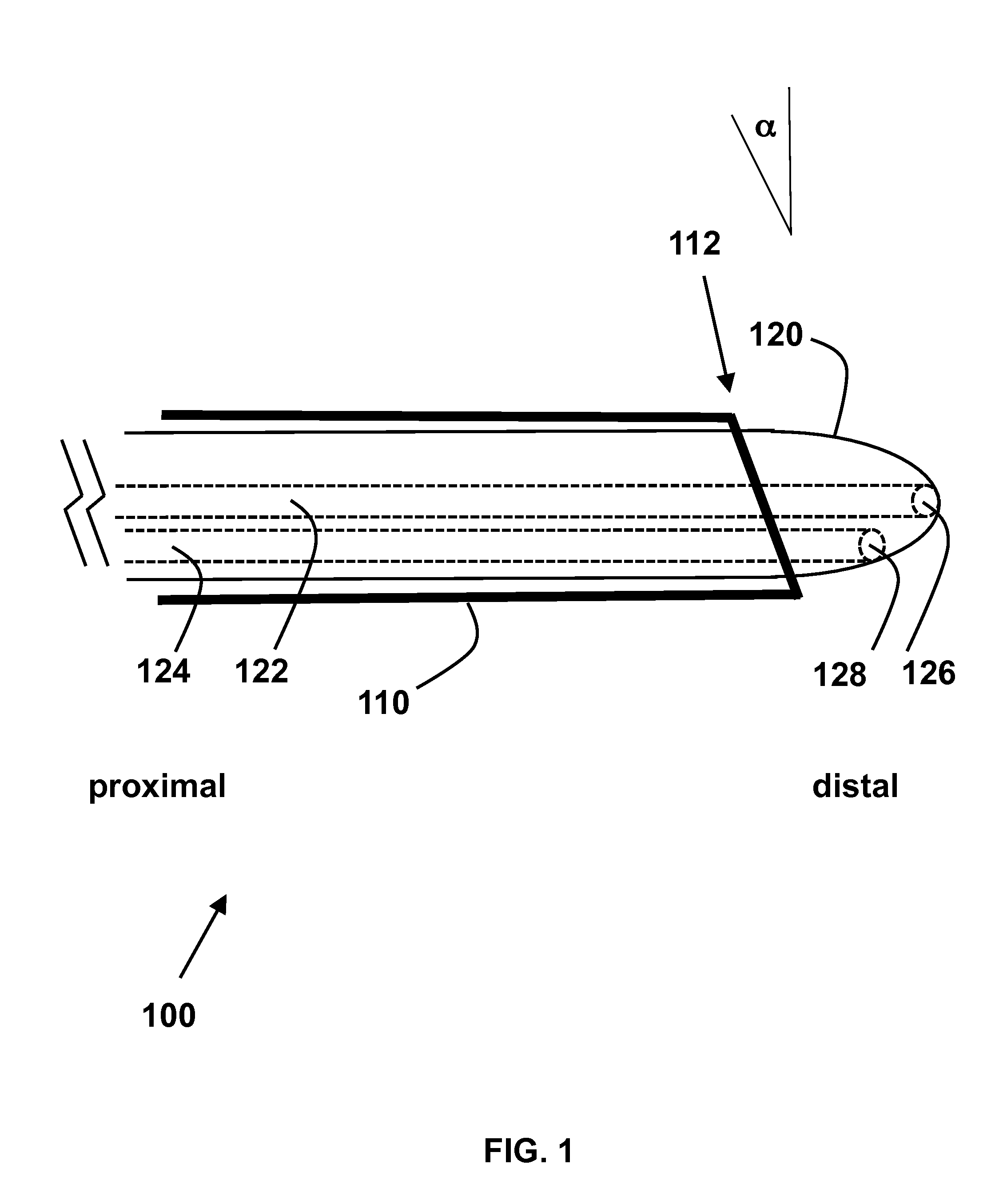 Interventional radiologic devices and methods for embedded filter removal