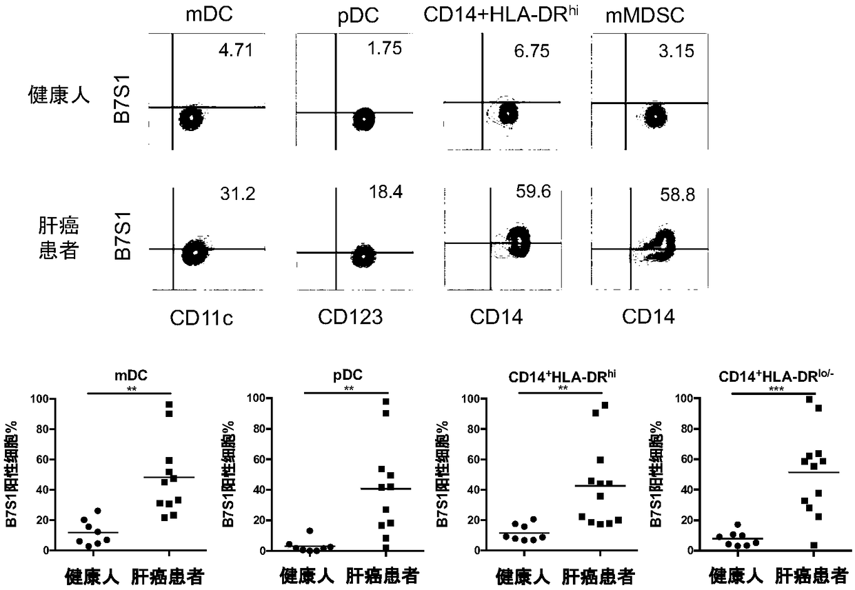 Application of B7S1 (B7 family member 1) inhibitor in preparing liver cancer medicine